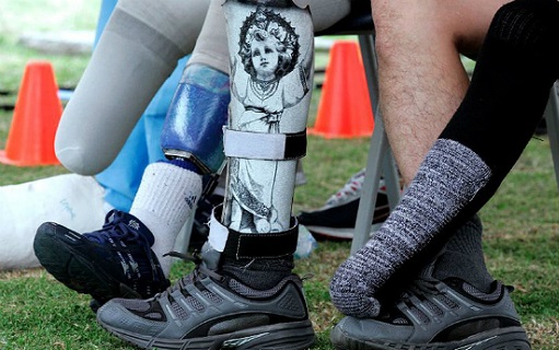 10 PERSONAS POR DÍA SALTAN POR EL AIRE AL PISAR UNA MINA.  Es el triste primado que ostenta Colombia, mientras en Cuba se habla de paz